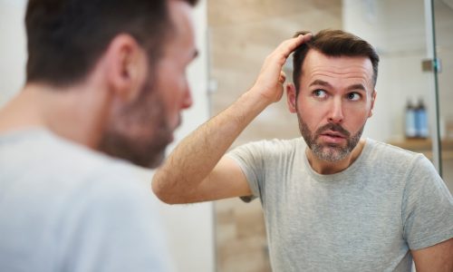 Jak powstrzymać łysienie u mężczyzn?