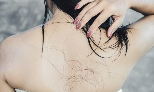 Wypadanie włosów po umyciu – przyczyny, zapobieganie